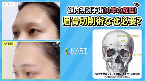 眉骨 出てる 男|眉骨の出っ張りって長所なんでしょうか